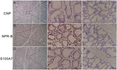 C-Type Natriuretic Peptide Regulates the Expression and Secretion of Antibacterial Peptide S100A7 in Goat Mammary Gland Through PKG/JNK/c-Jun Signaling Pathway